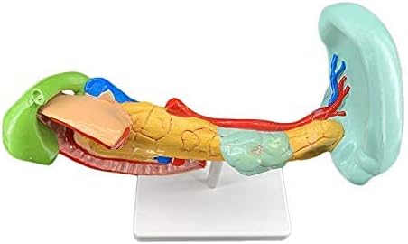 Duodenal Modeli-İnsan Organ Anatomisi Modeli Patolojik Duodenal Modeli - Tıbbi Anatomik Hastalıklı Duodenal için Çalışma Ekran